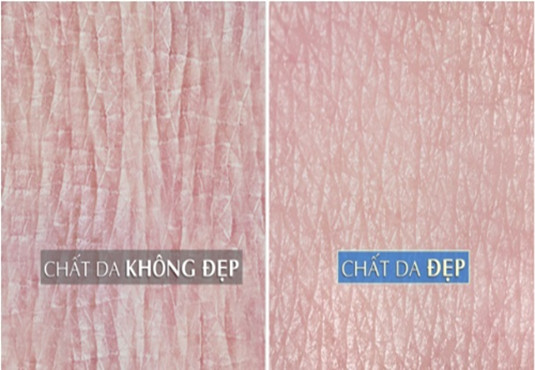 tiêu chuẩn của một làn da đẹp